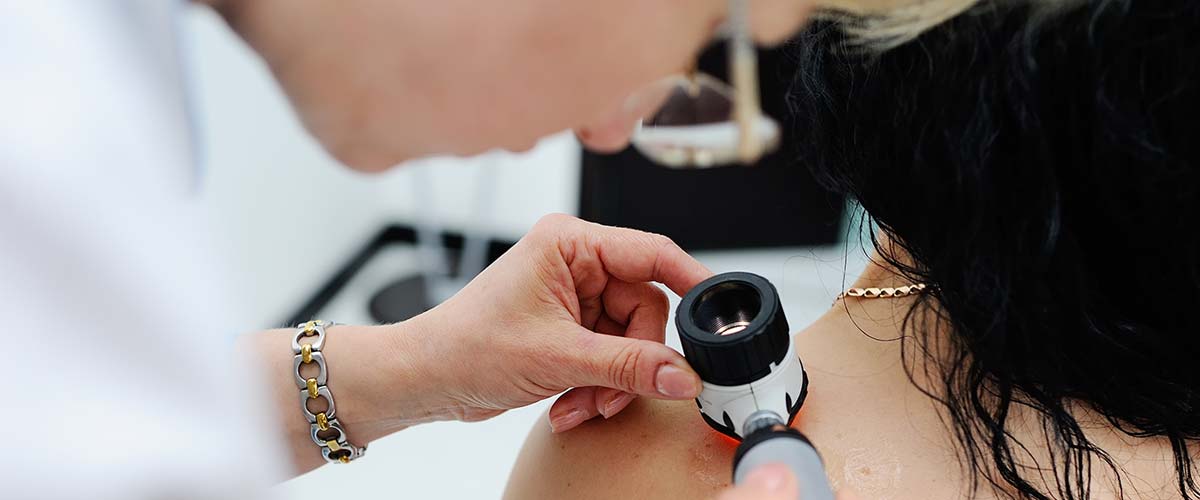 Doctor checking back for melanoma 